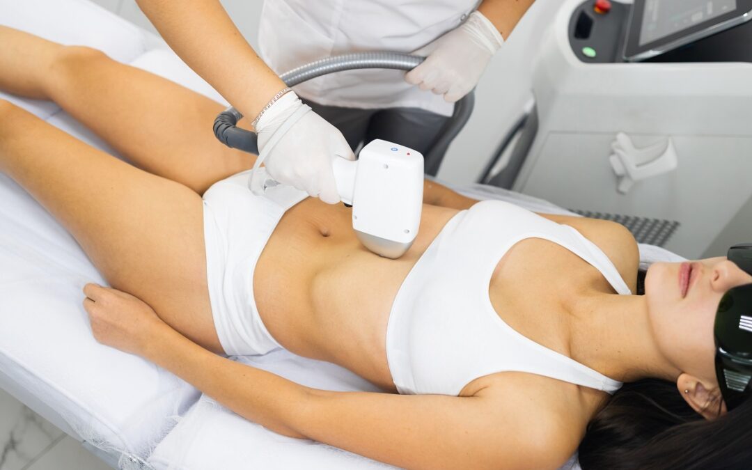Full body laser hair removal for women
